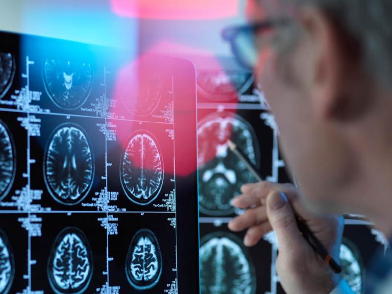 Physician reviewing multiple images of a brain scan