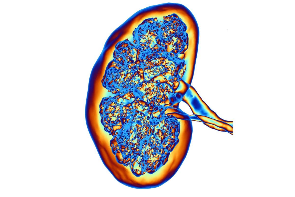 CT scan of a kidney