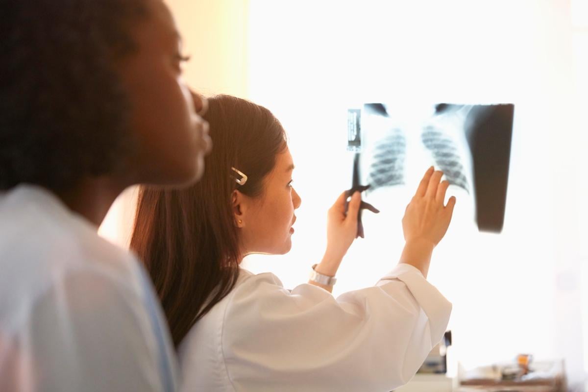 Two health care professionals looking at a chest x-ray.