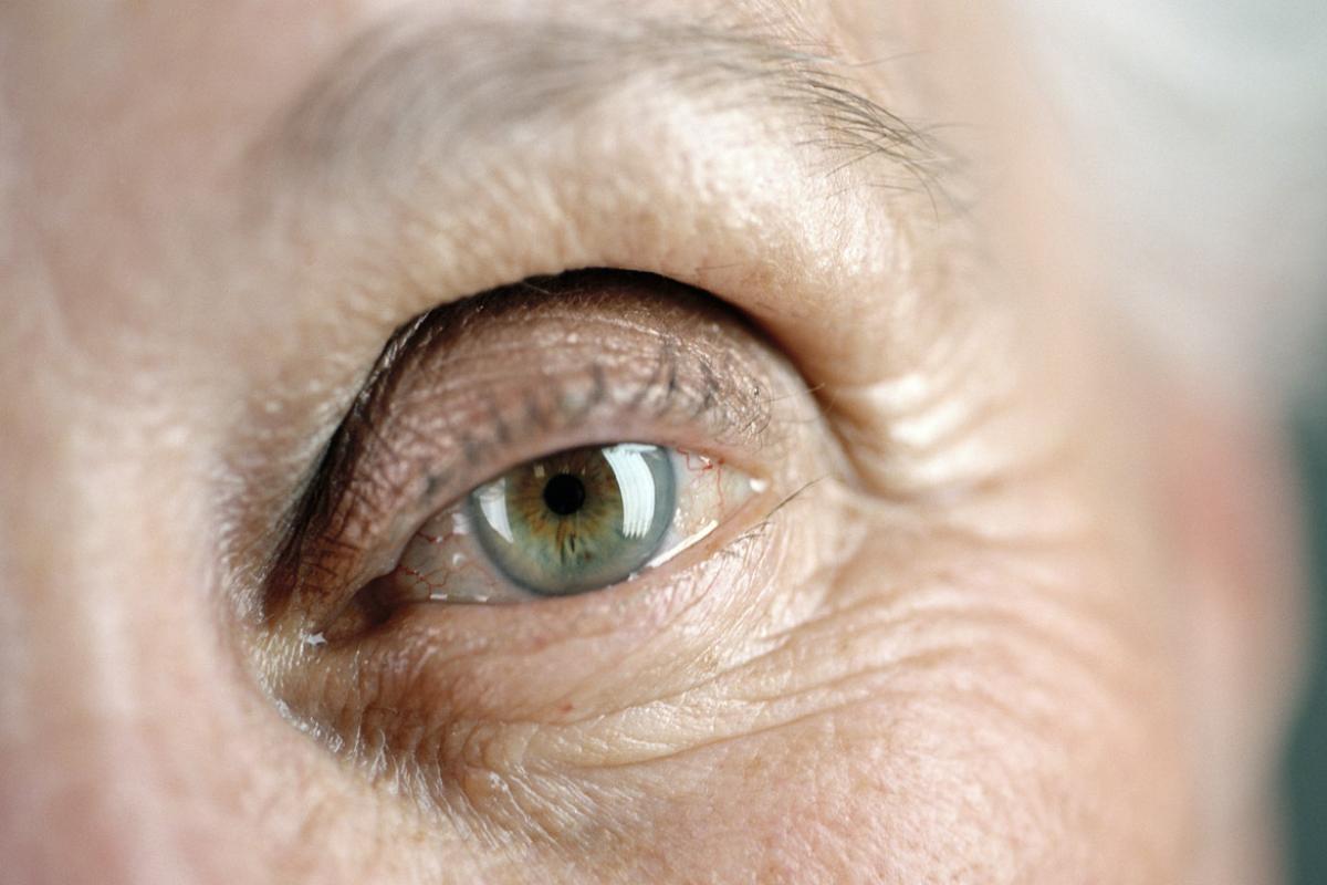 Close up of an elderly person's left eye, with the iris a gray color.